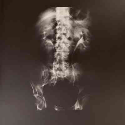 Light Memory #21 (Spine)