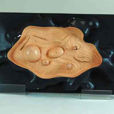 Amoeba Model