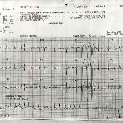 Medical chart for William Previty, 76 years old. 4 Jun 1990