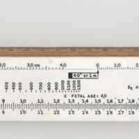 Slide rule: Picker X-ray Fetal Medical, made by K&E Co., [Hoboken], n.d., ca. 1950s-1967.