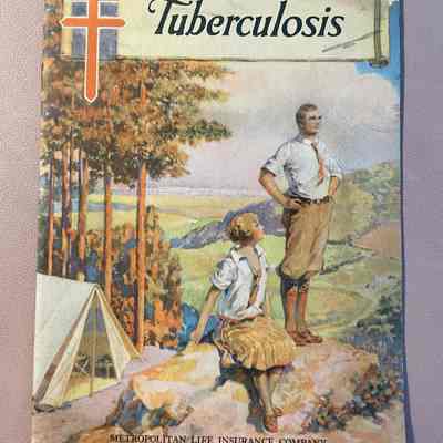Tuberculosis
