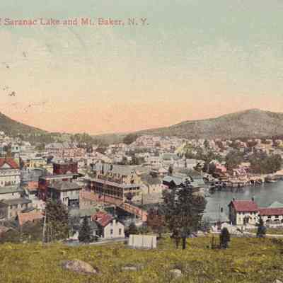 General View of Saranac Lake and Mt. Baker, N. Y.