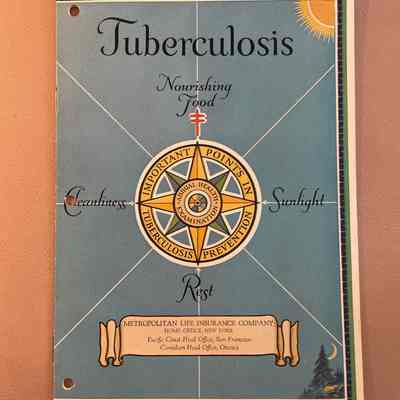 Tuberculosis