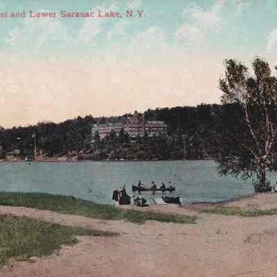 Ampersand Hotel and Lower Saranac Lake, N.Y.