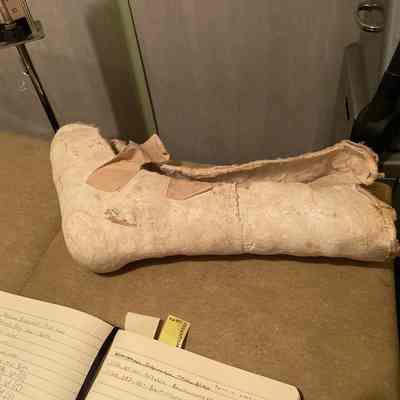 Plaster Cast