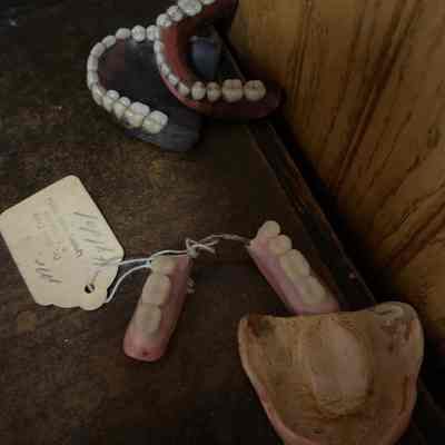 Four Dentures