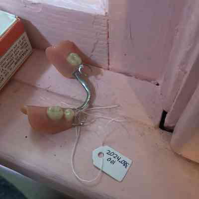 Partial Denture