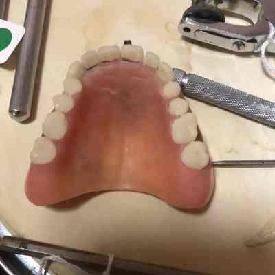 Denture