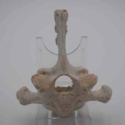 Vertebra