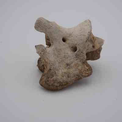 Vertebra