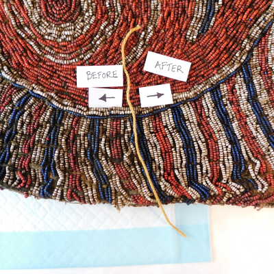 Before/After, Treatment in Progress