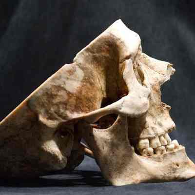 Skull