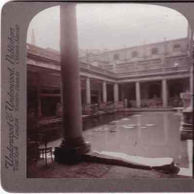Stereograph