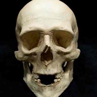 Skull