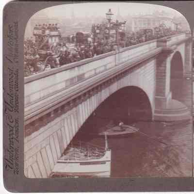 Stereograph