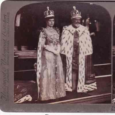 Stereograph