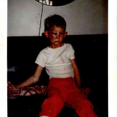 Mike McCleary after Riding Accident