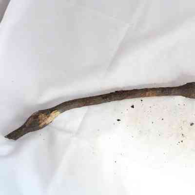 metal artifact