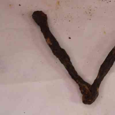 Metal Artifact
