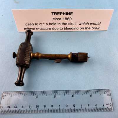 TREPHINE