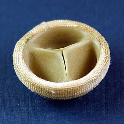 Roe Aortic Prosthetic Heart Valve (4)