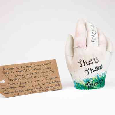 The image shows a hand cast with "They Them" written, accompanied by a handwritten note.