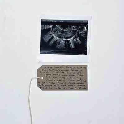 A black and white photo of a ultrasound scan. With a brown handwritten luggage tag.