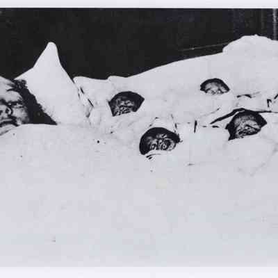 Dionne Quintuplets