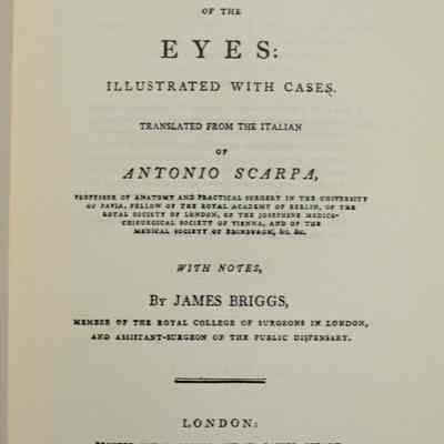 On the principal diseases of the eyes: illustrated with casas