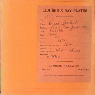 Glass plate X-Ray, foot of Herbert Clark, and envelope, ordered by Dr. Bull, 1912