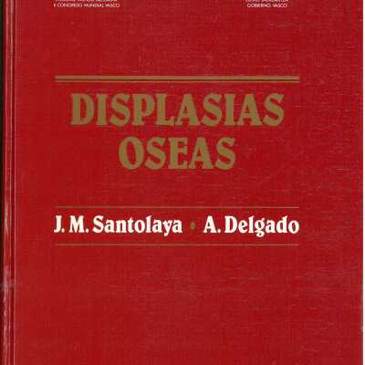Displasias Oseas
