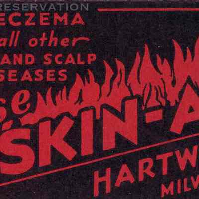 Skin-A-Fire matchbook