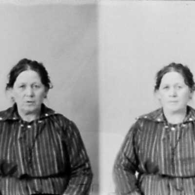 Double Photo of Woman in Striped Dress
