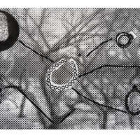 Canopy I