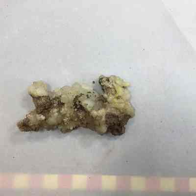 White Botryloidal Quartz