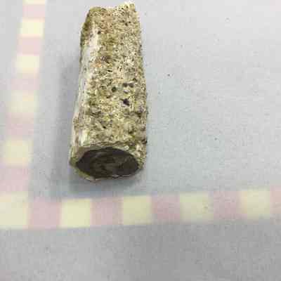 Limb Cast