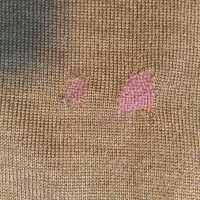          An expert darning job on elbow.
   