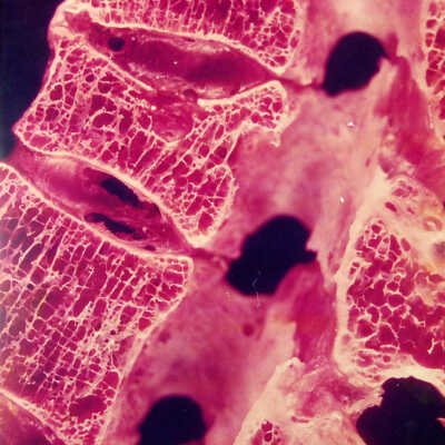 Bone Magnified