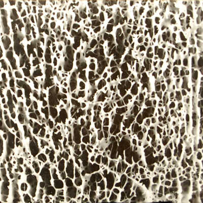 Bone Magnified