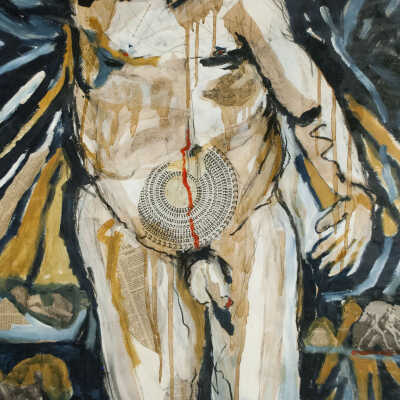 Self-Portrait--After Belly Surgery
