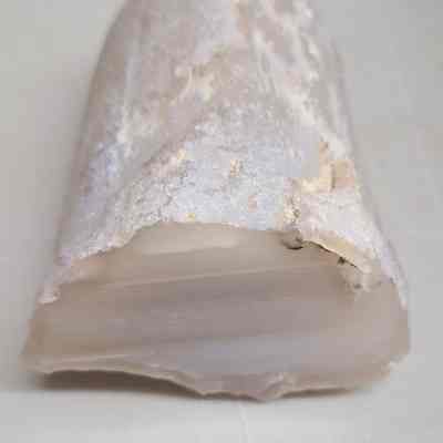 Limb Cast