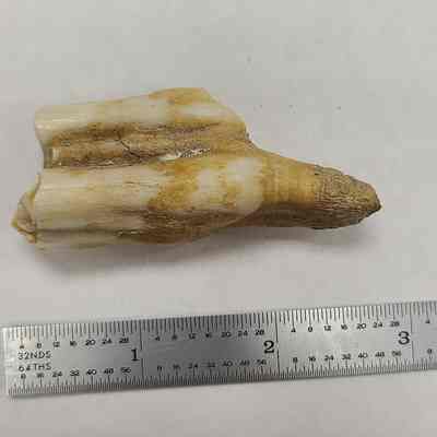 Tooth