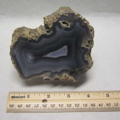 Limb Cast