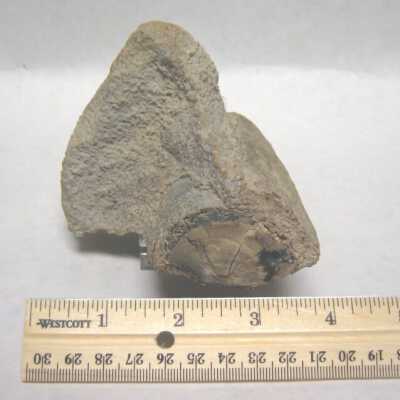 Limb Cast