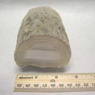 Limb Cast