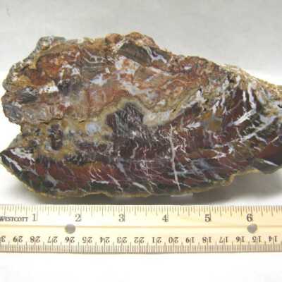 Limb Cast