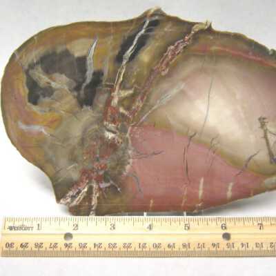 Limb Cast