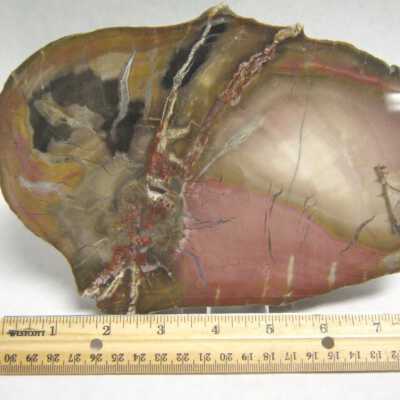 Limb Cast