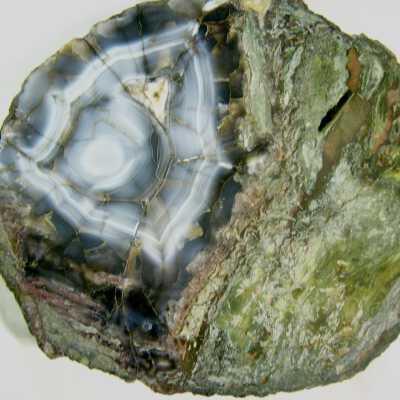 limb cast