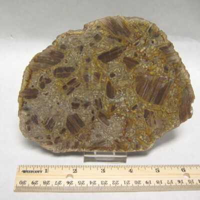 Limb Cast